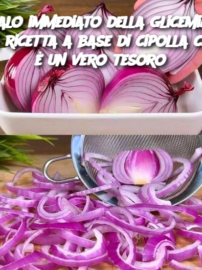 Calo immediato della glicemia: la ricetta a base di cipolla che è un vero tesoro
