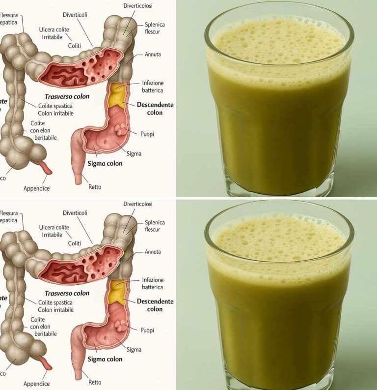 “Succo Detox Intestinale: La Ricetta Naturale che Libera il Corpo dalle Tossine”