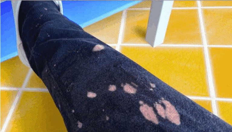 Ecco come rimuovere le macchie di candeggina dai tessuti